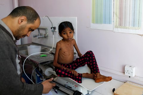 Hunger stalks Yemen's remote villages after four years of war