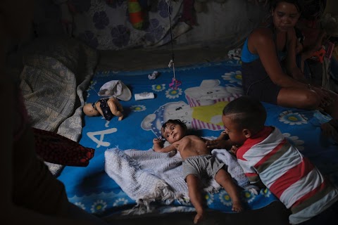 Malnutrition curses the children of Venezuela
